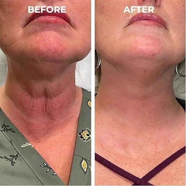 SKIN FIRMING REJUVENATING SERUM,SKIN FIRMING SERUM FOR FACE AND NECK,SKIN FIRMING REJUVENATING SERUM,SKIN FIRMING, SERUMREFRESHING AND NON-STICKY, FOR ALL SKIN TYPES
