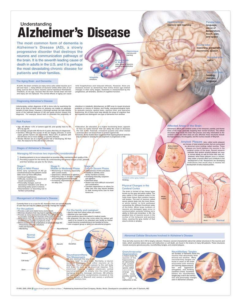 Anatomical Chart Understanding Alzheimer's Disease