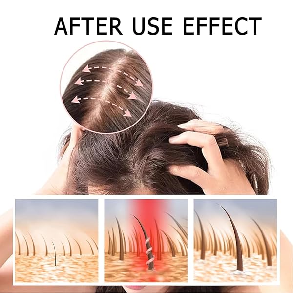 GINGER ANTI HAIR LOSS SHAMPOO, PLANT SHAMPOO FOR HAIR GROWTH OIL CONTROL HAIR CARE FOR WOMEN MEN.(1 BOX)