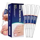 Nail Fungus Pen, Toenail Fungus Pen Treatment for Toenail & Fingernails, Fungal Nail Repair Pen For Nail Damage, Discoloration by Fungi