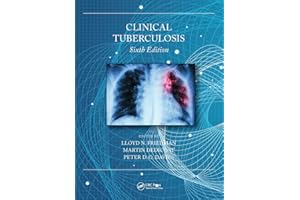 Clinical Tuberculosis