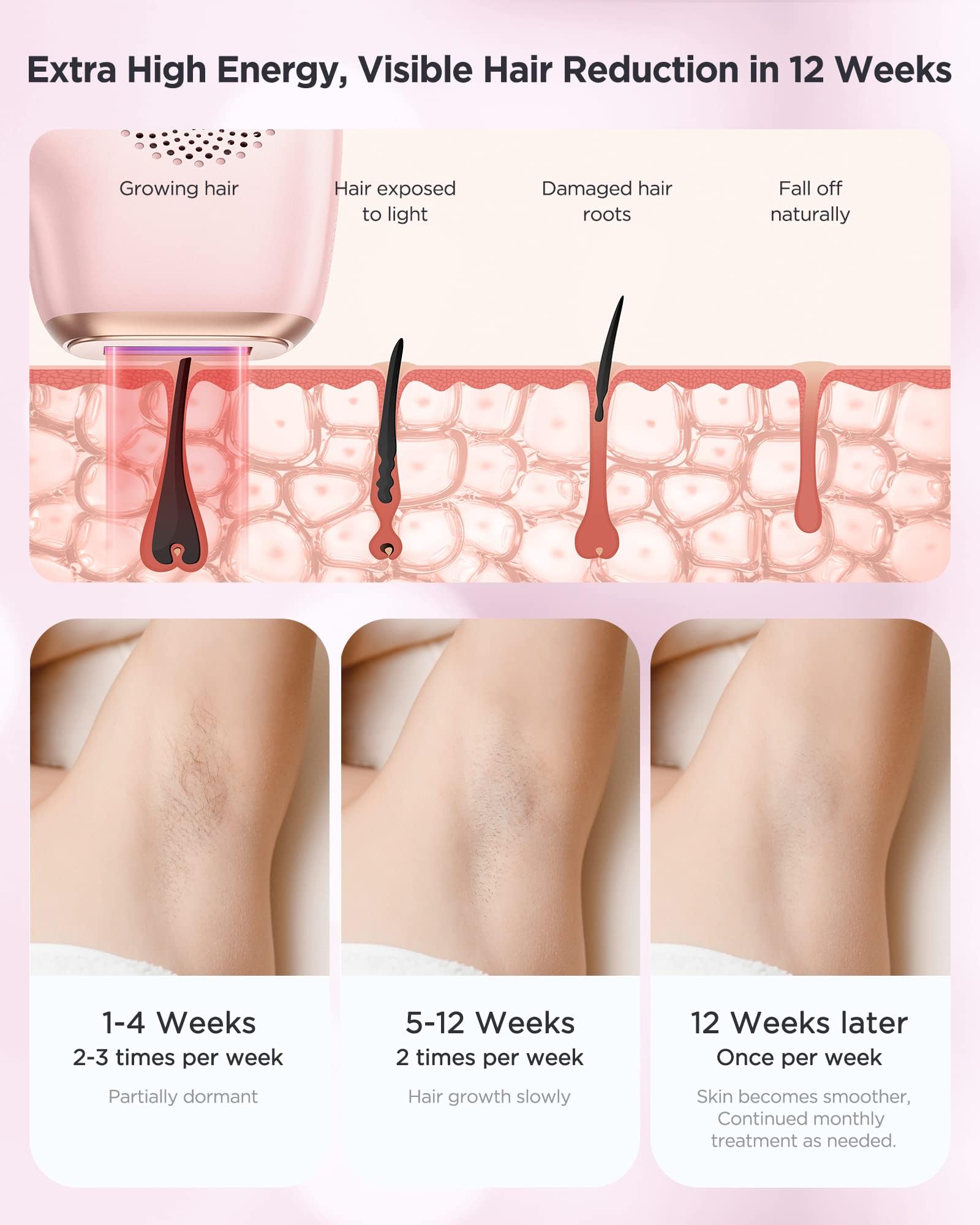 INNZA IPL Hair Removal Device for Women and Men at Home,Permanent Hair Remover Machine,10 Energy Levels,24J High Energy Hair Removal Handset for Face Bikini Line Armpit Leg Back,Corded