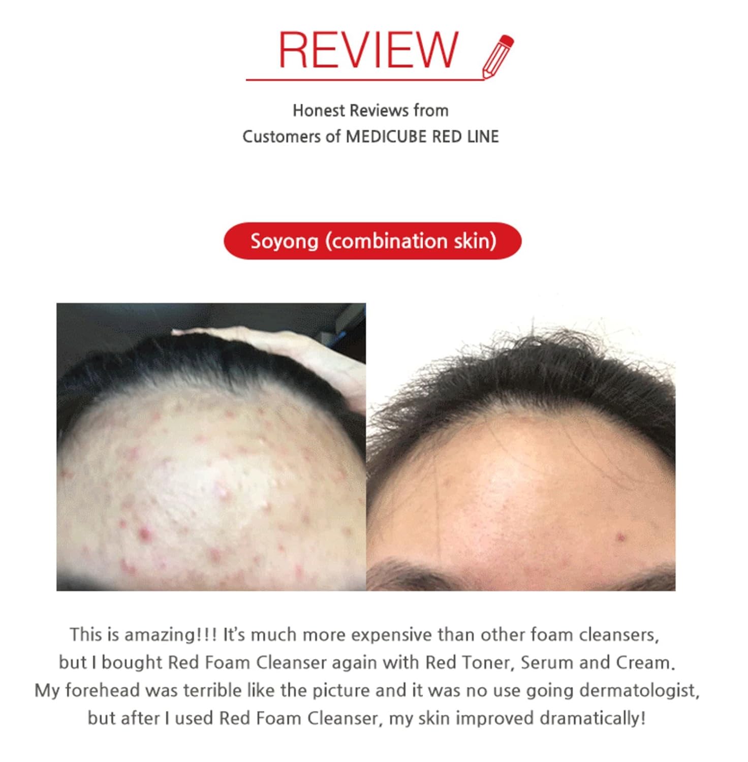 medicube red body wash