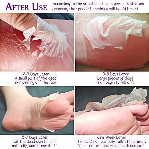 Amazon Com Foot Peel Mask 2 Pack For Cracked Heels Dead Skin Calluses Make Your Feet Baby Soft Get Smooth Silky Skin Removes Repairs Rough Heels