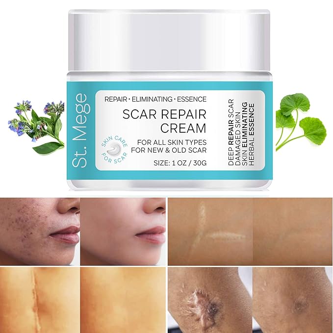 milis skin repair cream