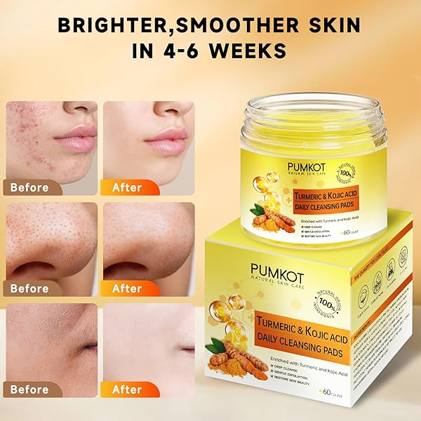 PUMKOT TURMERIC KOJIC ACID CLEANSING PADS, TURMERIC FACE SCRUB PADS ENRICHED WITH KOJIC ACID AND TURMERIC, 60PCS