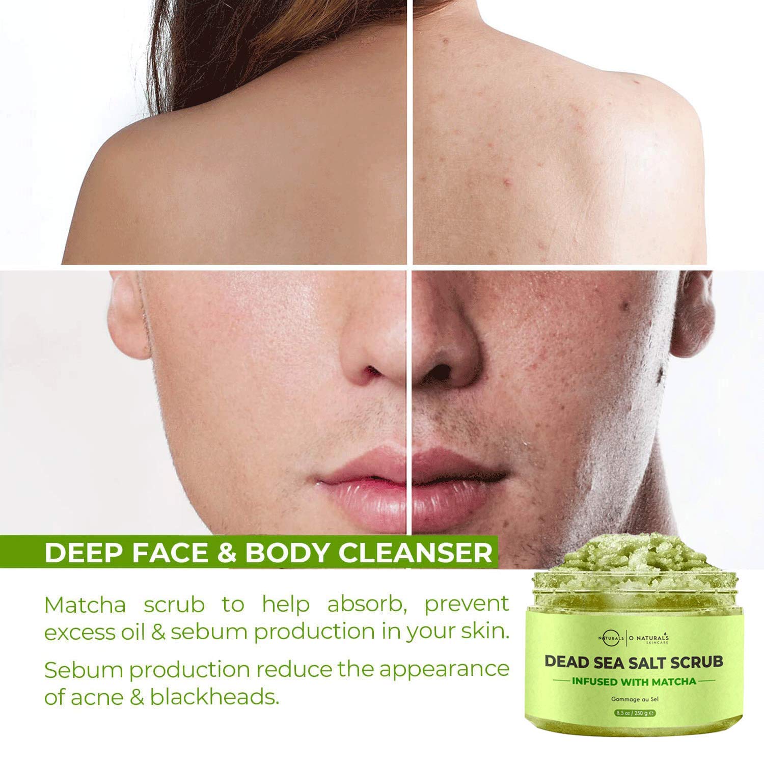 O Naturals Anti-Cellulite Exfoliating Organic Caffeine Matcha Dead Sea Salt Scrub For Face Body & Foot Best Acne Eczema Stretch Marks Wrinkles Varicose Veins Boosts Circulation For Women & Men 8.45oz : Beauty