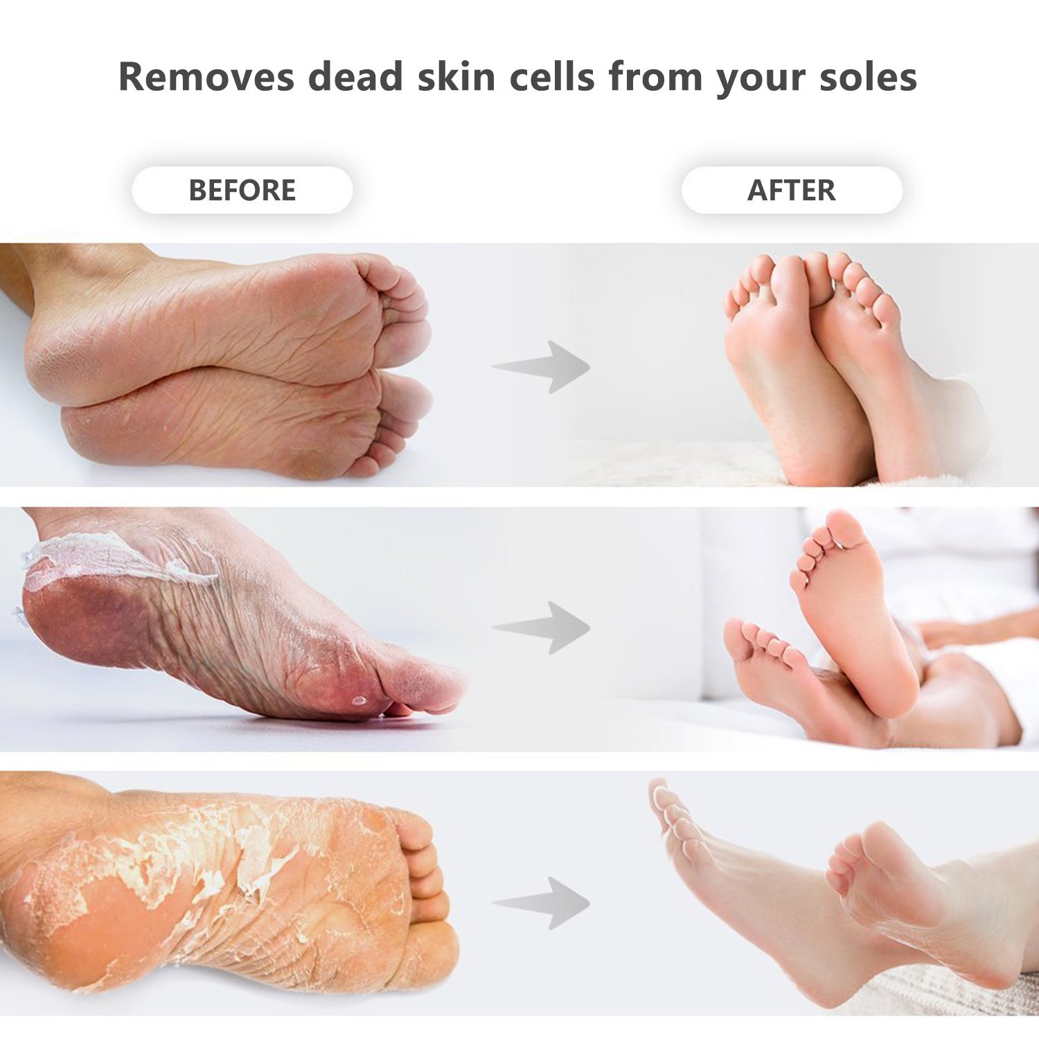 Premium Fußmaske, Babyfüße, Fuß Peeling Maske, Peeling Socken, iSuri 2 Paar Roseextrakt Exfoliating Foot Peel Mask für Männer Frauen- hervorragende Ergebnisse in 3-7 Tagen …