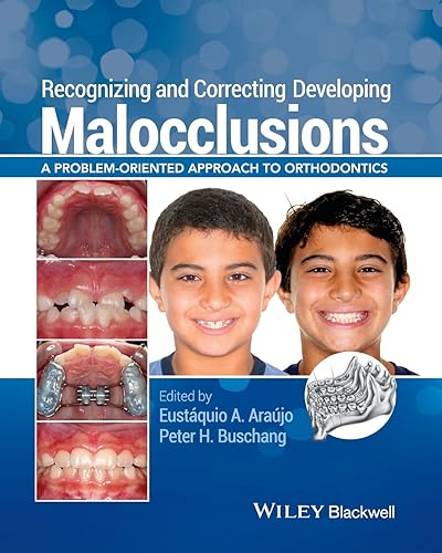 Download Recognizing and Correcting Developing Malocclusions: A Problem-oriented Approach to Orthodontics PDF