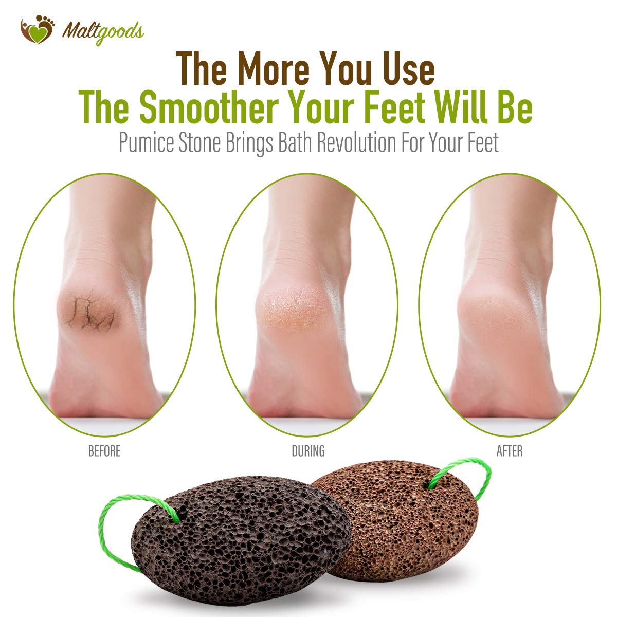 Nature Pumice Stone for Feet,2 PCS Lava Pumice Stone for Heels Callus Removal, Pedicure Exfoliator for Dry Dead Skin with a Cleaning Brush: Beauty