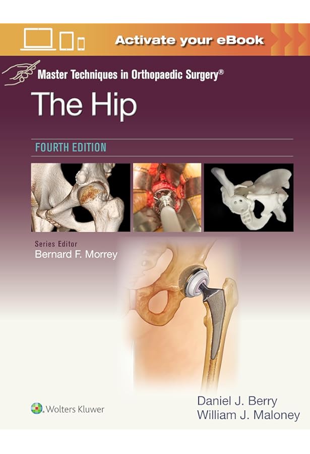 Master Techniques in Orthopedic Surgery: Knee Arthroplasty