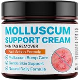 SHUNNIUB Molluscum Support Treatment, Molluscum Support Cream All Natural Support Cream for Molluscum Rash