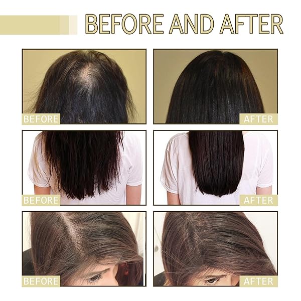 2PCS VEGANIC NATURAL HAIR GROWTH OIL, EELHOE IMPROVES BLOOD CIRCULATION,REDUCE HAIR LOSS,FOR DRY DAMAGED HAIR.(120ML)