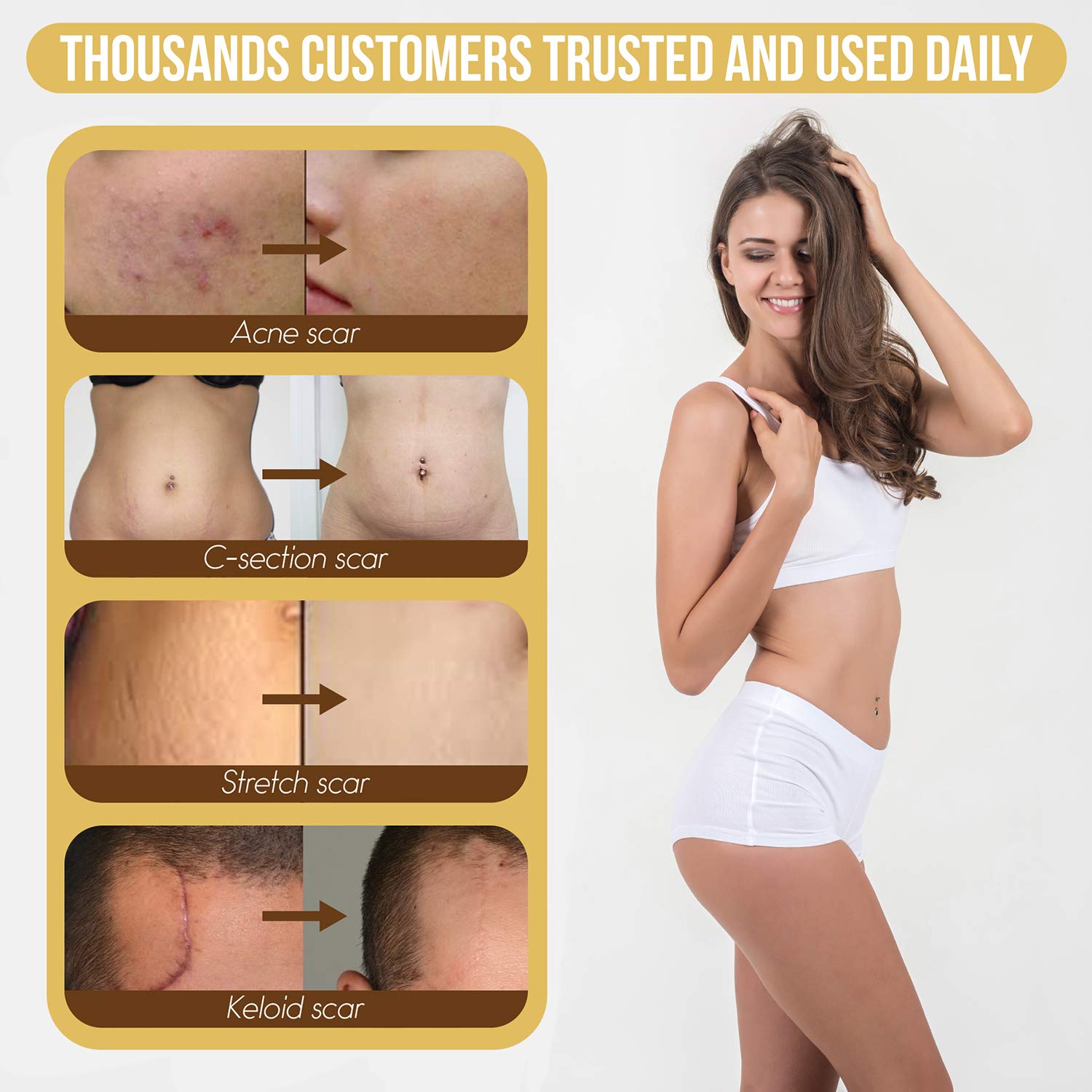HANASCAR Professional Silicone Scar Removal Sheets, Treat Scars Caused by C-Section, Surgery, Burn, Injuries, Acne, and Stretch Marks, Works on Old & New Scars, 5.7"×1.57”, 4 Reusable Sheets : Beauty