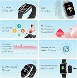 UMIDIGI Uwatch 5S Smart Watch Gold 1.7" Touch Screen Heart Rate Sleep Monitor view 3