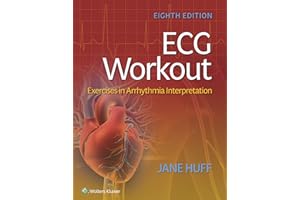 ECG Workout: Exercises in Arrhythmia Interpretation