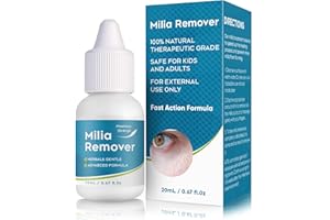 MSNOR Milia Treatment, Milia Remover Helps Quickly Dissolve and Reduce Milia, Whitehead, cysts and Sebaceous Hyperplasia
