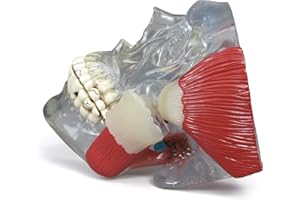 GPI Anatomicals - Temporomandibular Joint (TMJ) Model, Replica with Pathologies for Human Anatomy and Physiology Education, Anatomy Model for Doctor's Offices and Classrooms, Medical Study Supplies