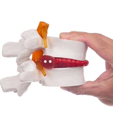 Japard Cervical Spine Model With Cervical Vertebrae, Cervical Nerves - View #9