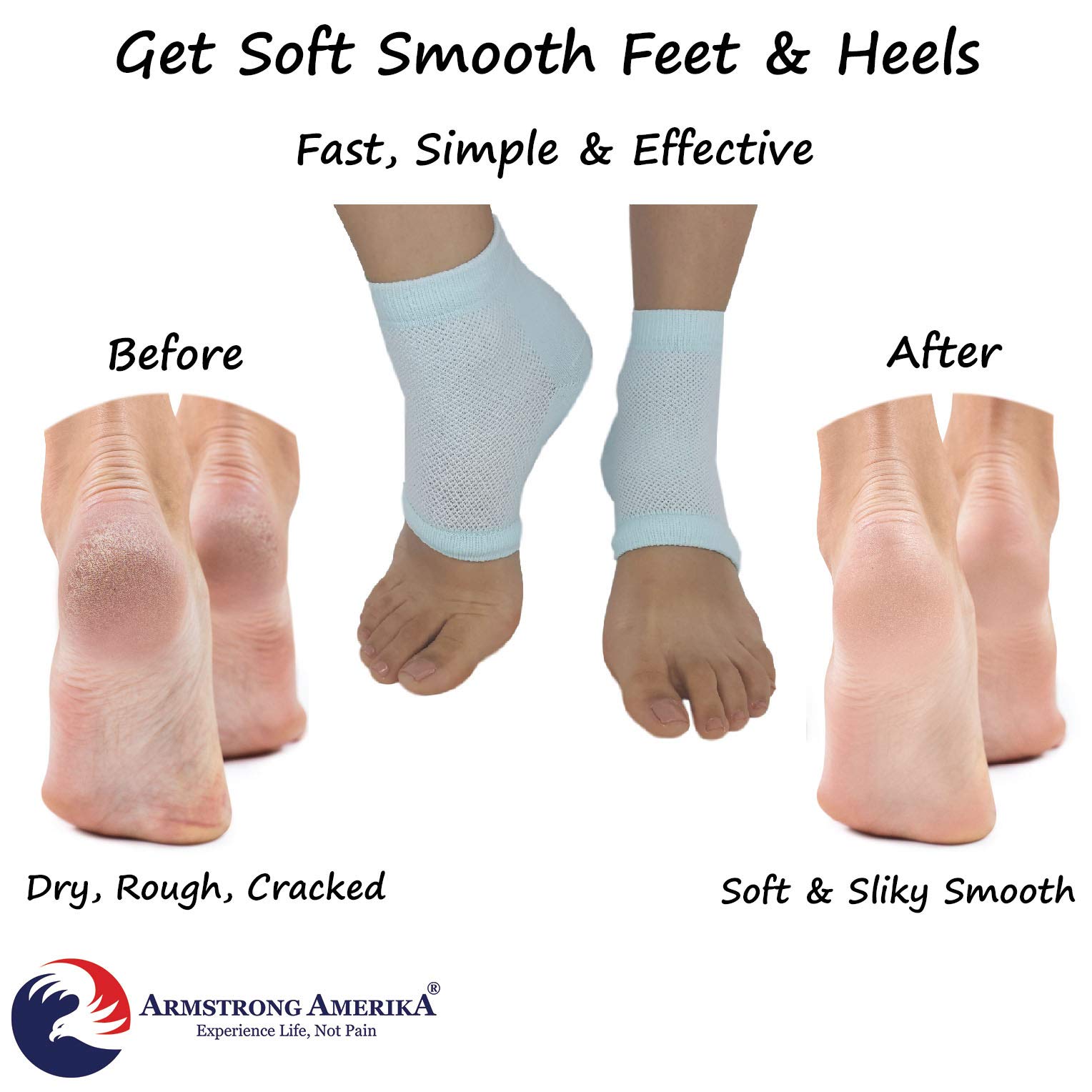 Galleon Moisturizing Socks For Cracked Heels Aloe Socks To Treat