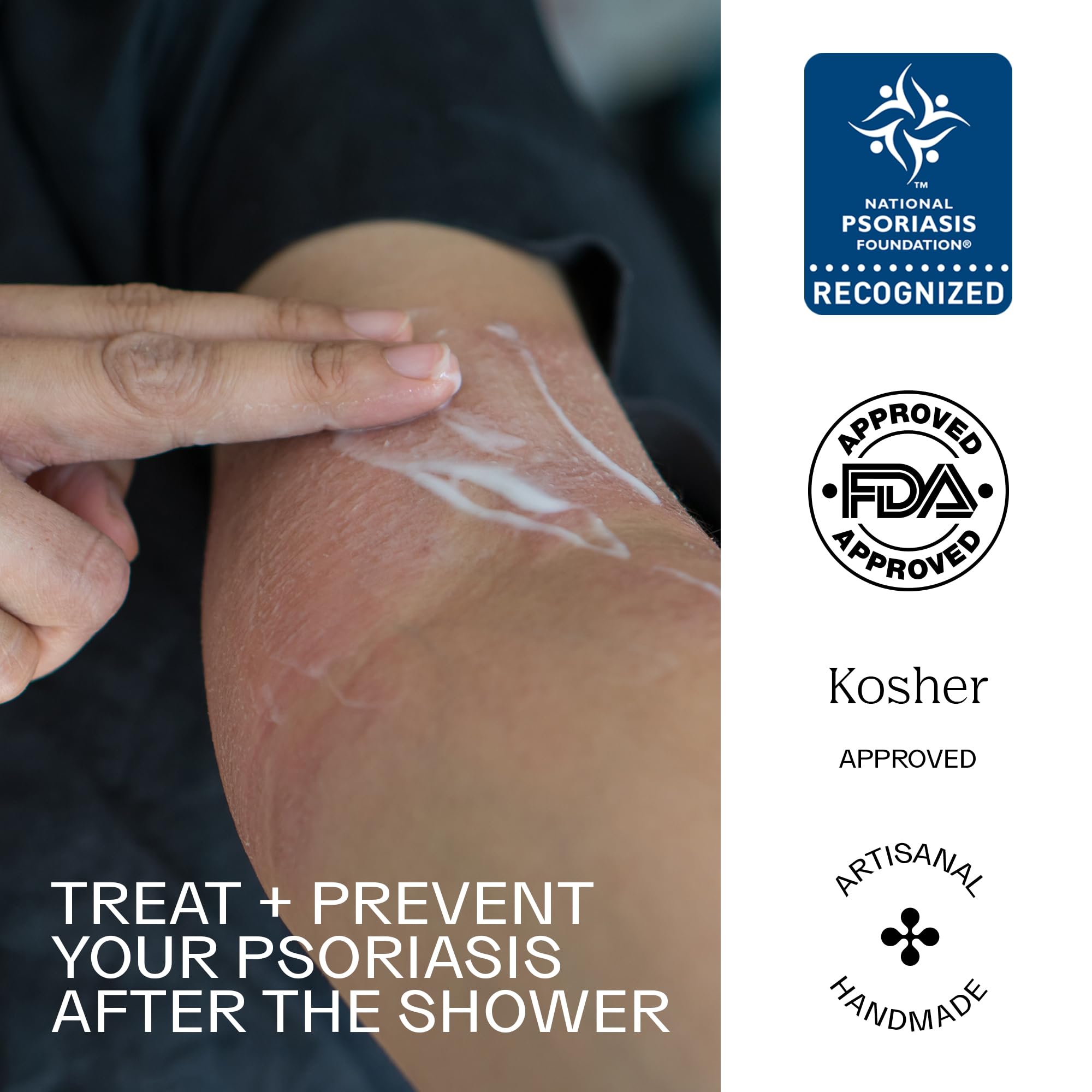 Dermabon Seborrheic Dermatitis Cream, Eczema & Psoriasis Treatment - Calendula Extract, Salicylic Acid, Bee Wax -Soothes, Hydrates & Balances Skin Tone - Moisturizing & Skin Relaxing Relief