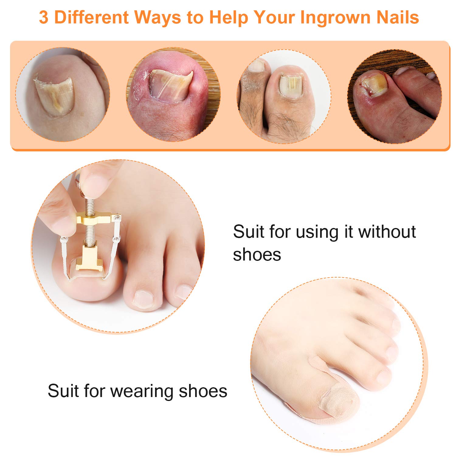 13 Pieces Ingrown Toenail Tools Kit, Includes Ingrown Toenail Lifter Ingrown Toenail Tool Toe Clamp, Ingrown Toenail Stickers, Curved Toenails Brace Stickers, Ingrown Toenail Files and Lifter: Beauty