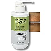 X20Hair Psoriasis Shampoo for Men & Women 1% Zinc Pyrithione for Itchy, Flaky Scalp | Hydrating Daily Scalp Care with Aloe,Hyaluronic Acid & Botanical Extracts | Hydrating Dandruff Formula