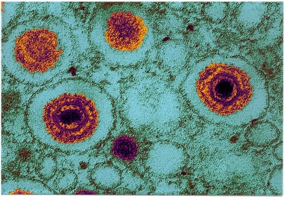 CafePress – Herpes Virus, TEM – Imán rectangular para refrigerador, 2 x