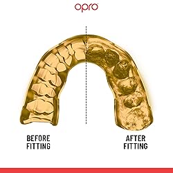 OPRO Instant Custom-Fit Sports Mouth