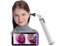 Wireless Otoscope Ear Camera with Dual View, 3.9mm 720PHD WiFi Ear Scope with 6 LED Lights for Kids and Adults, Compatible wi