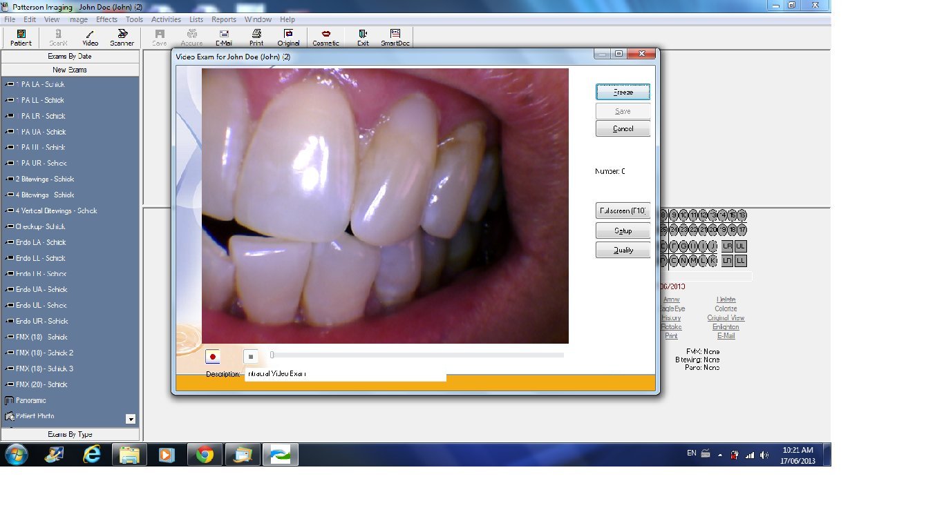 DARYOU DY50 Intraoral Camera Dental Camera ,Super Clear.Work With Most Imaging