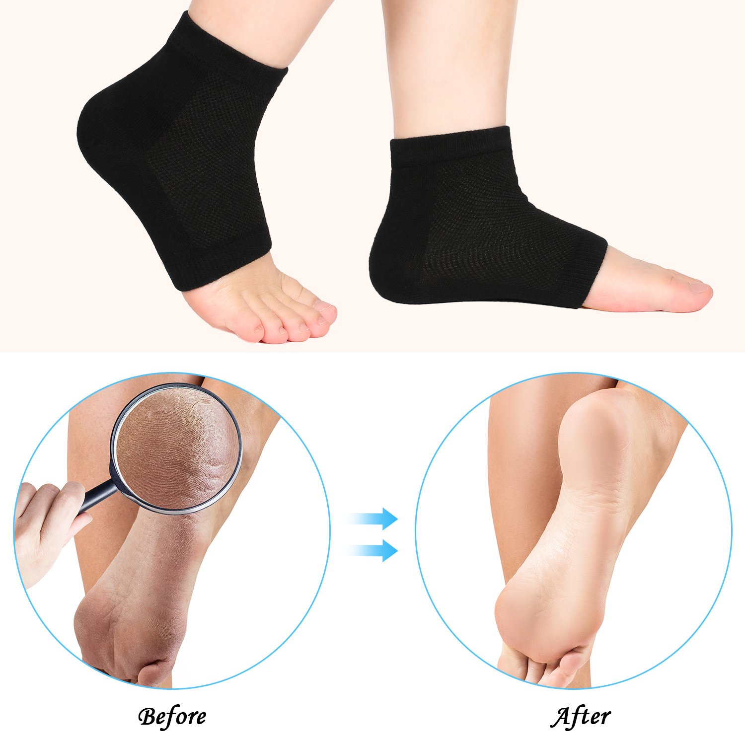 Soft Ventilate Gel Heel Socks Open Toe Socks for Dry Hard Cracked Skin Moisturizing Day Night Care Skin, 3 Pairs (Regular Size, Black) : Beauty