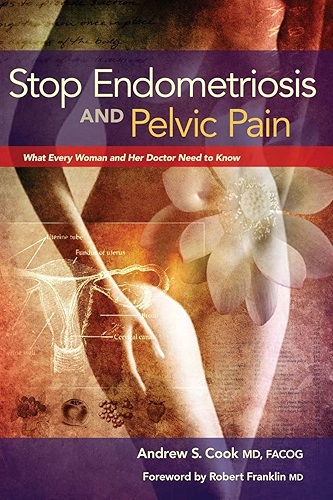 Download Stop Endometriosis and Pelvic Pain: What Every Woman and Her Doctor Need to Know (English Edition) PDF