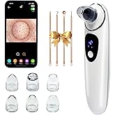 2026 Pore Vacuum with Camerafor, USB Rechargeable Blackhead Remover Vacuum,3 Levels Adjustable Pore Vacuum Blackhead Remover, 6 Suction Heads,Face Vacuum Pore Cleanser for Women & Men-White