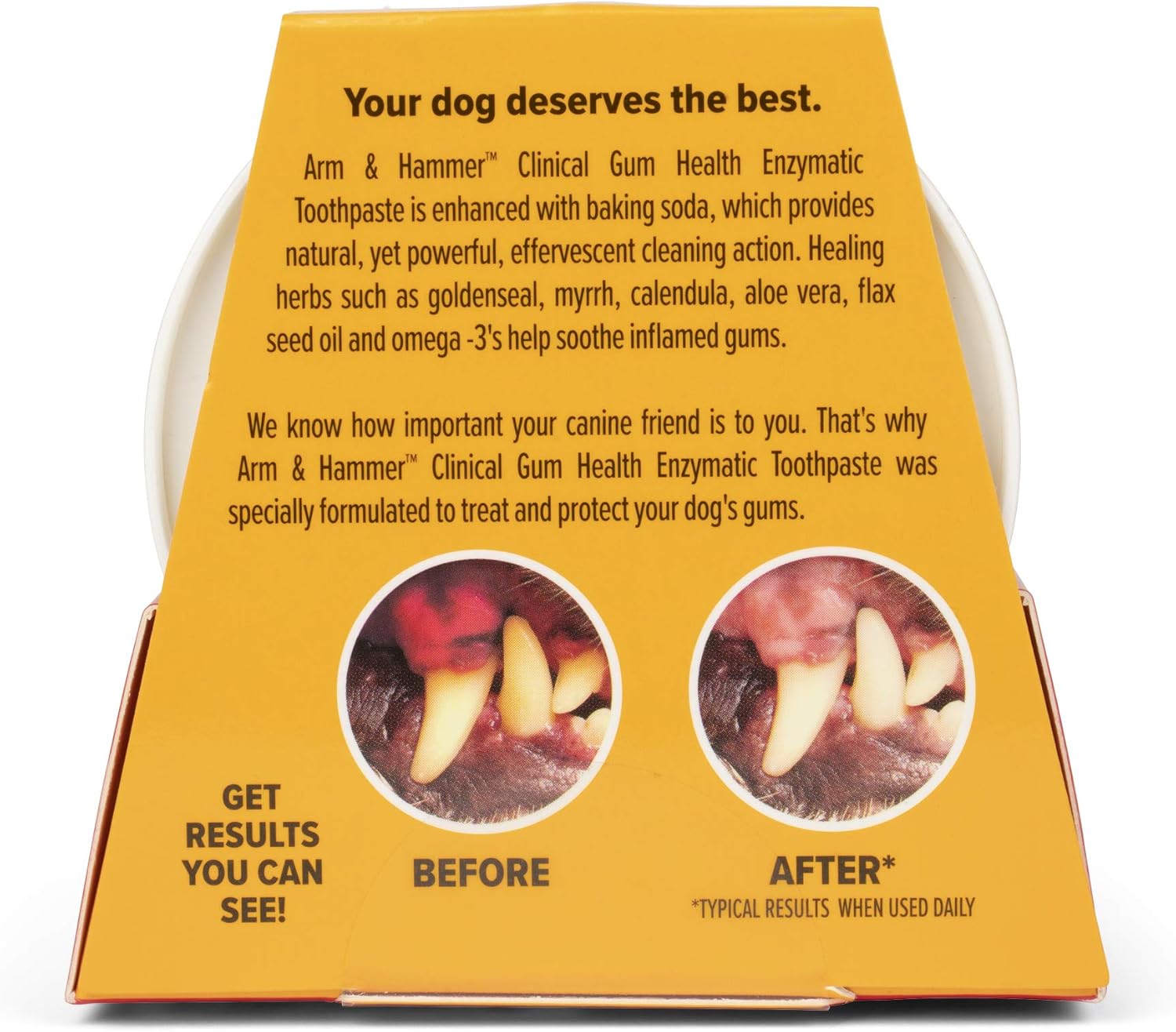 Arm & Hammer Dip & Brush Clinical Gum Health Enzymatic Toothpaste Kit