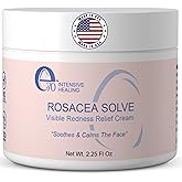 e70 Rosacea Treatment for Face Skincare Cream for Women & Men (Pack of 1) - Gentle Moisturizer Redness Reducing Skin Care - with Aloe Vera & Hyaluronic Acid - Day-Night, Made in USA (2.25 fl. oz.)
