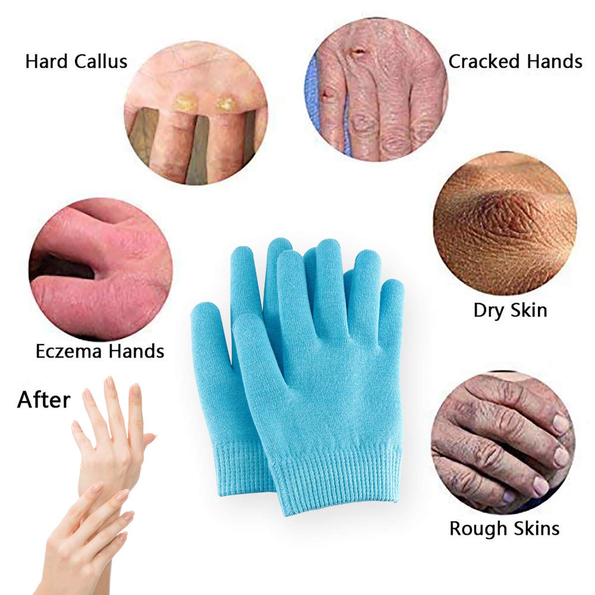 Happon Moisturizing Gel Gloves Soft Spandex with Thermoplastic Gel Repair Heal Eczema Cracked Dry Skin, Gel Lining Infused with Essential Oils and Vitamins for Dry Hard Cracked Skin - Blue : Beauty