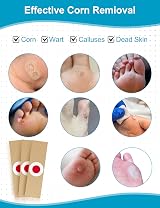 MQFORU Corn Remover Pads 28Pcs Foot Wart Remover Patch view 3