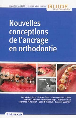 Download Nouvelles conceptions de l'ancrage en orthodontie PDF