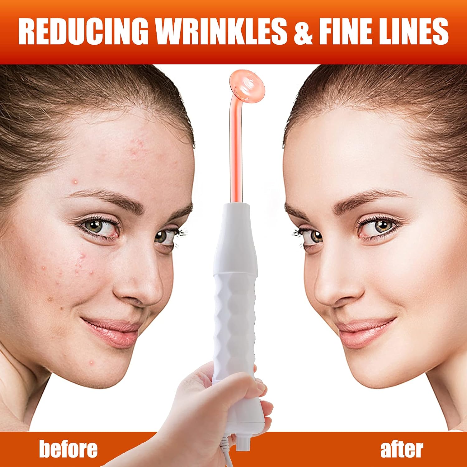 High Frequency Machine, AMDAILY Portable Handheld High Frequency Facial Wand w/Neon for Personal Beauty Acne Spot Wrinkles Remover Eyes Body Care Hair Follicle Stimulator 4-in-1: Beauty