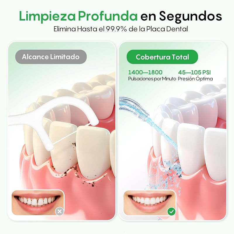 Irrigador Dentário Portátil de 300 ml Irrigador Oral