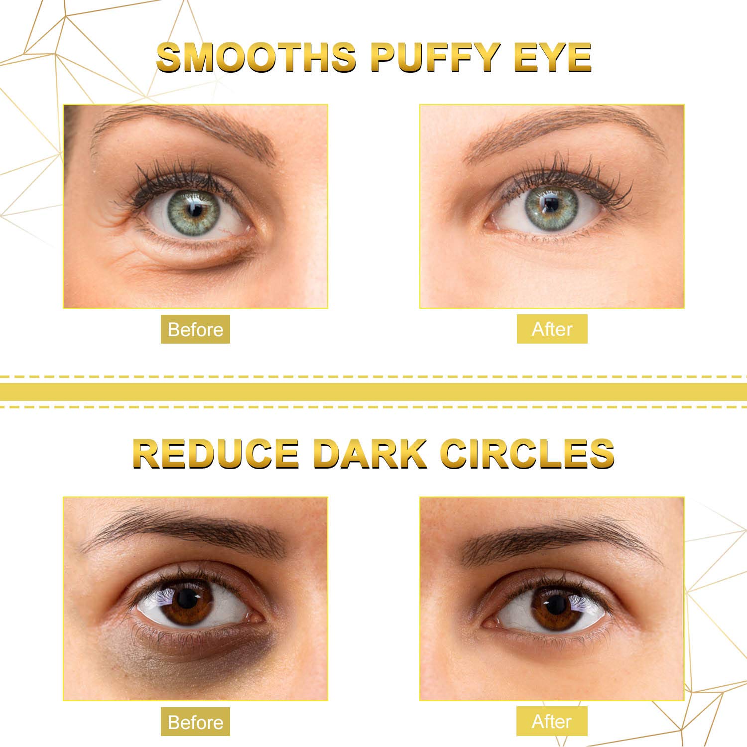 Under Eye Mask, SWAN STAR Under Eye Patches for Dark Circles and Puffiness, 24K Gold Eye Mask Anti-Aging Hyaluronic Acid Collagen Eye Pads for Women and Men, Reducing Dark Circles and Wrinkles Eye Patch, 20 Pairs : Beauty