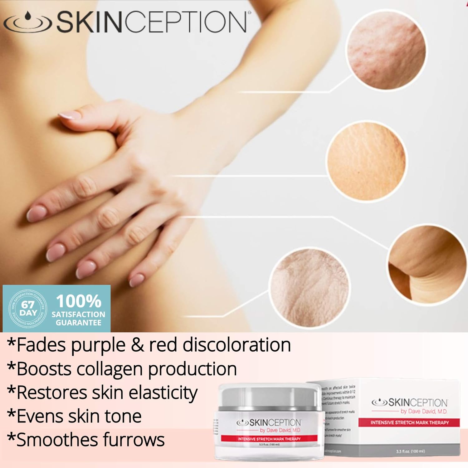 skinception stretch mark therapy