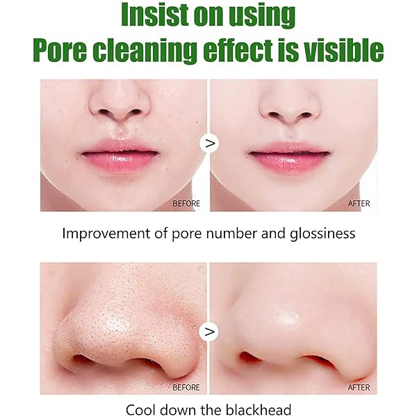 LOVEMIN GREEN TEA BLACKHEAD REMOVER MASK STICK FOR FACE, DEEP CLEANSING, PORELESS SKIN TREATMENT, UNISEX
