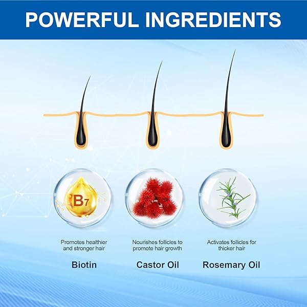 HAIR GROWTH SERUM, HAIR LOSS TREATMENTS FOR MEN & WOMEN, HAIR REGROWTH FOR MEN, HAIR GROWTH OIL SPRAY, COMBAT HAIR LOSS & THINNING HAIR, 100ML