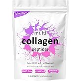 Multi Collagen Peptides Powder - Hydrolyzed Collagen Types I, II, III, V, X for Skin, Hair, Nails & Joint Support - Unflavored, Gluten-Free, Easy to Mix - Non-GMO, Paleo Friendly 16oz (1 Pack)