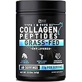Zeal Naturals Hydrolyzed Collagen Peptides Powder, 10g Protein | Grass-Fed Collagen for Women & Men | Essential Amino Acids | Hair, Skin, Nails, Bone Health | 45 Servings, Unflavored,