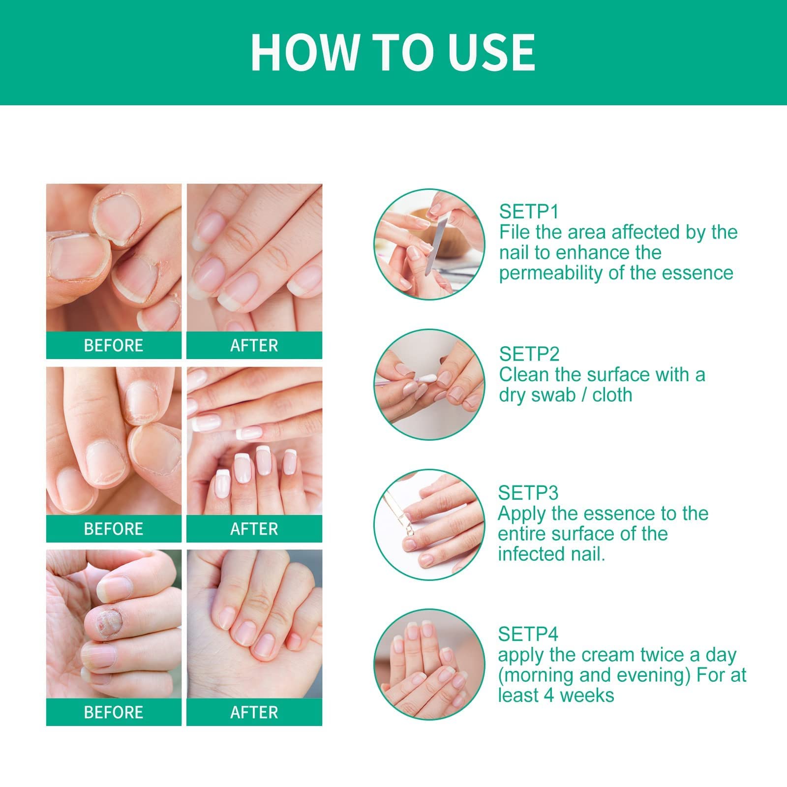 3Pack Kerassentials Toenail Treatment Oil, Kerassentials for Toenail, Kerasentials Nail Treatment, Extra Strength for Repairing - Image 3