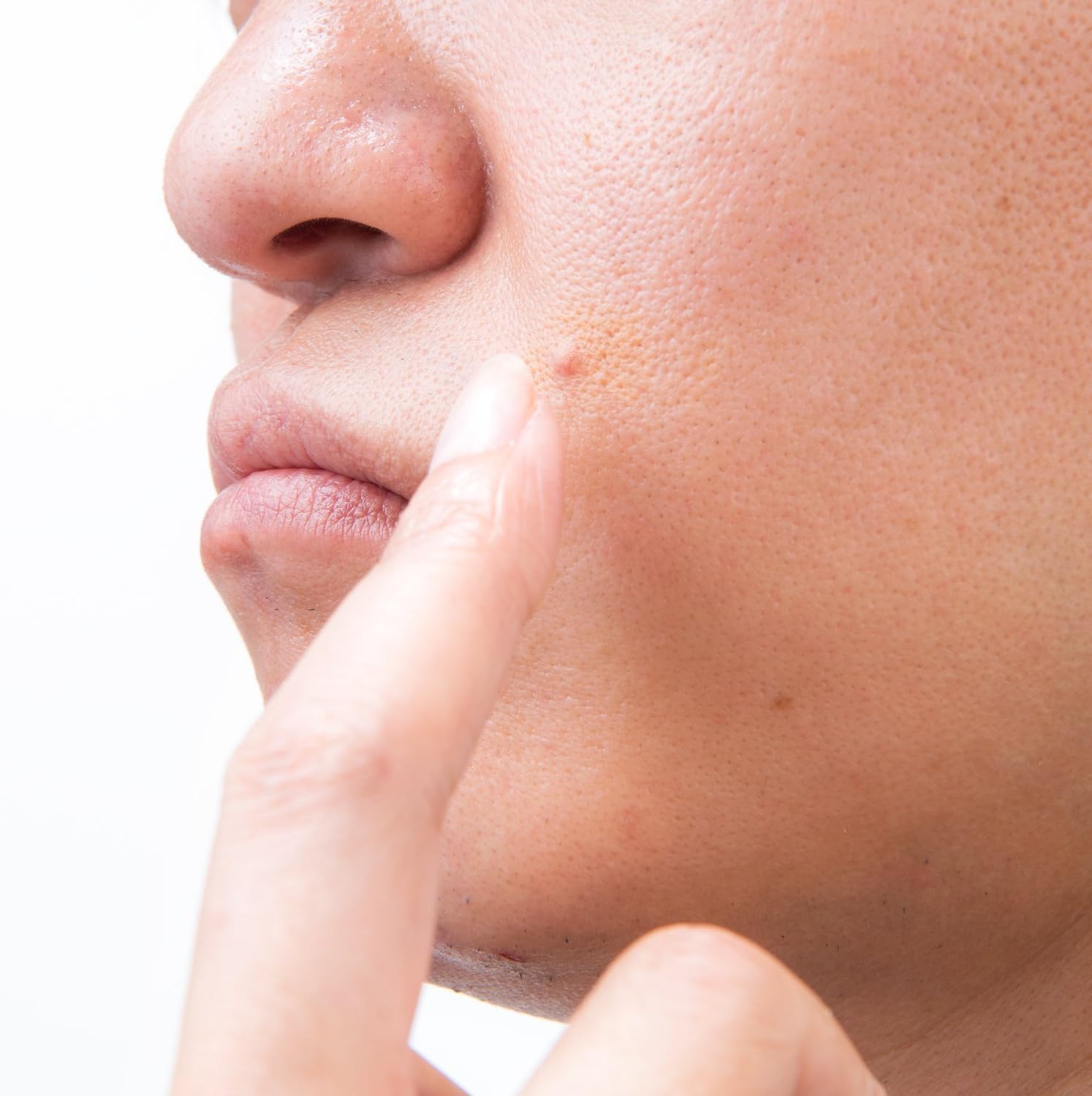 Amazon 医薬部外品 エテュセ オム 薬用アクネ コンシーラー ライト 明るめの肌色 10g Ettusais Homme エテュセオム コンシーラー 通販