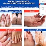 TIS farmaceutic Urea 15% Cream for Eczema, Psoriasis, Dry Rough Skin view 4